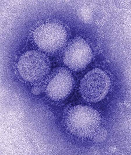 CDC lab photo
The H1N1 flu virus