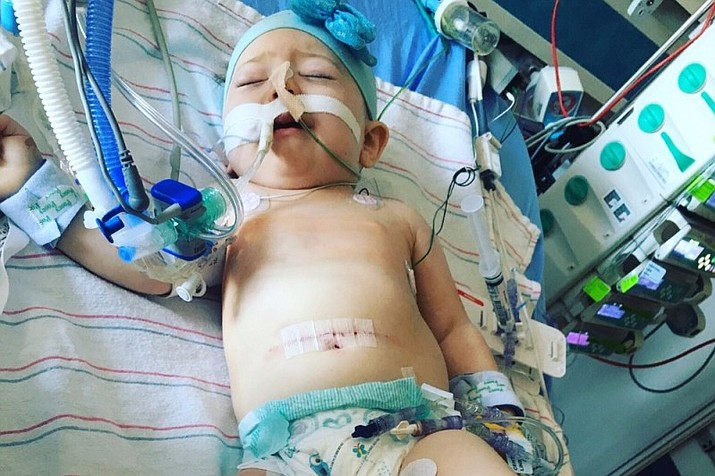 One-year-old Gabrielle, daughter of Steve and Stephanie Farmer of Chino Valley, suffered a serious intestinal malfunction Thursday, Aug. 11. She was rushed to Phoenix Children’s Hospital and has had to undergo more surgeries.