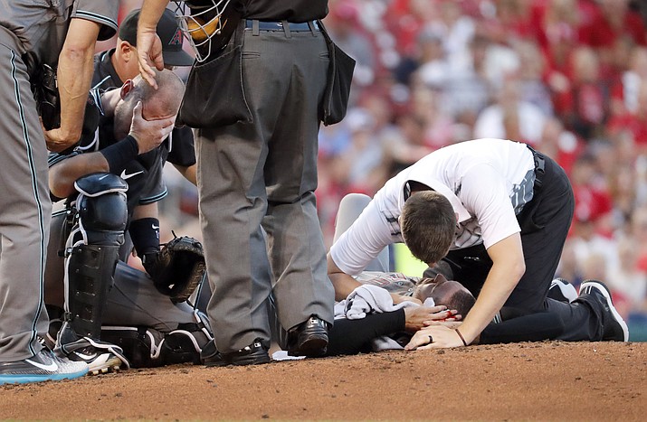Diamondbacks catcher Chris Herrmann covers his face, left, as Diamondbacks starting pitcher Robbie Ray, bottom right, is checked on by a trainer after being struck on the head by a line drive Friday, July 28, 2017, in St. Louis. (Jeff Roberson/AP)