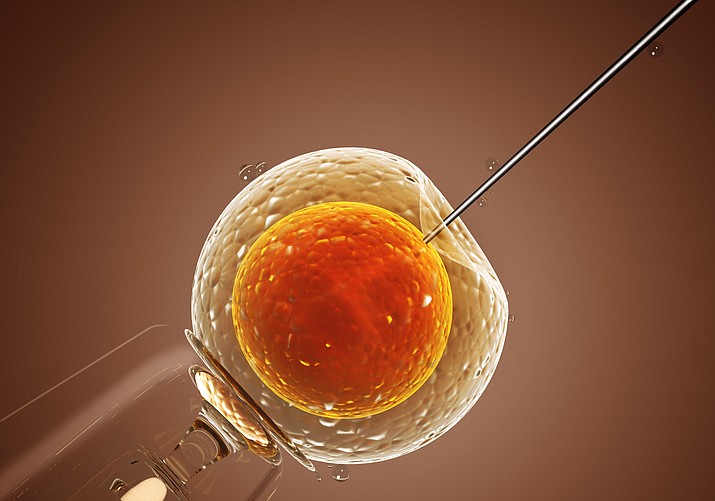 Cell injection in artificial insemination (Photo from stock.adobe.com)