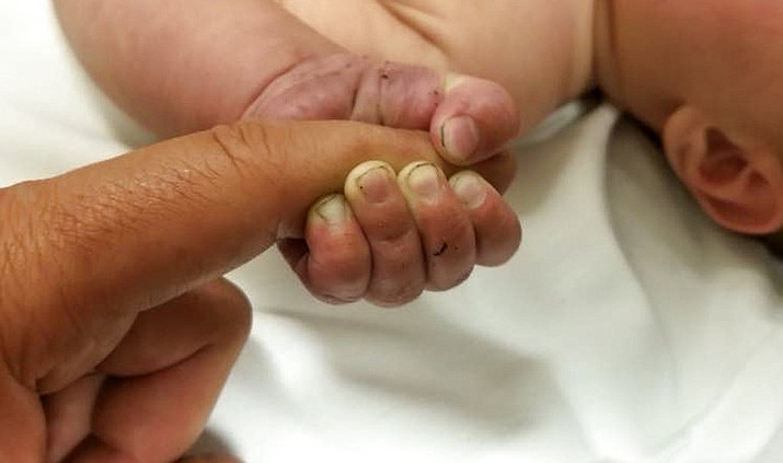 Pictured is a 5-month-old infant with dirt under its fingernails after authorities say the baby survived about nine hours being buried under sticks and debris in the woods. The Missoula County Sheriff's Office says the baby is in good condition at a hospital and calls it a "miracle" that the child survived the weekend ordeal. (Missoula County Sheriff's Office)