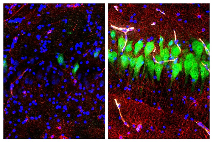 This combination of images shows stained microscope photos of neurons, green; astrocytes, red, and cell nuclei, blue, from a pig brain left untreated for 10 hours after death, left, and another with a specially designed blood substitute pumped through it. By medical standards “this is not a living brain,” said Nenad Sestan of the Yale School of Medicine, one of the researchers reporting the results Wednesday, April 17, 2019, in the journal Nature. But the work revealed a surprising degree of resilience within a brain that has lost its supply of blood and oxygen, he said. (Stefano G. Daniele, Zvonimir Vrselja/Sestan Laboratory/Yale School of Medicine)