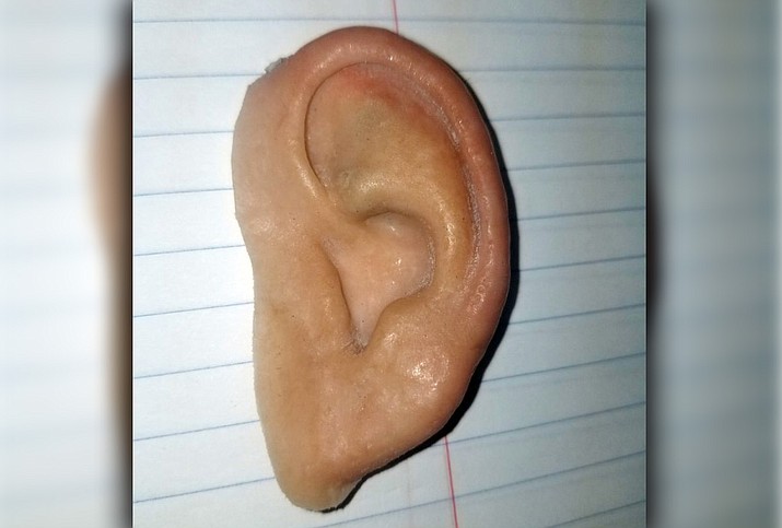 Prothesis 1882 03 image