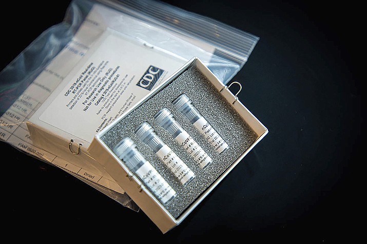 A virus testing kit is seen in this file image. (Associated Press)