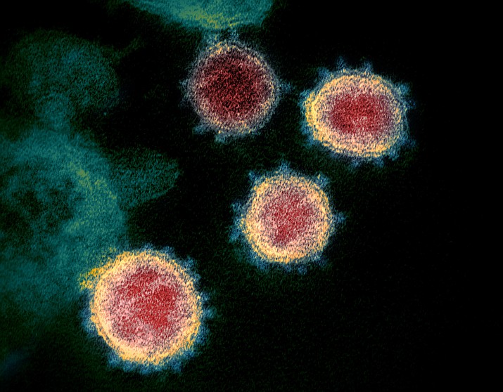 This undated electron microscope image made available by the U.S. National Institutes of Health in February 2020 shows the virus that causes COVID-19. (NIAID-RML via AP)
