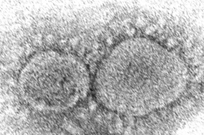 This electron microscope image shows SARS-CoV-2 virus particles which cause COVID-19. (Hannah A. Bullock, Azaibi Tamin/Centers for Disease Control and Prevention via AP)