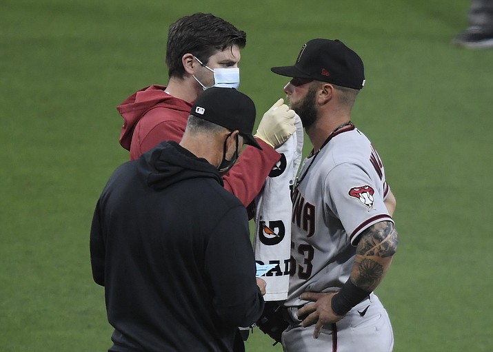 A trainer, top left, wipes Arizona Diamondbacks’ Christian Walker’s eye as manager Torey Lovullo looks on during the fourth inning of a baseball game against the San Diego Padres, Saturday, April 3, 2021, in San Diego. Walker was hit with the ball and was taken out of the game. (Denis Poroy/AP)