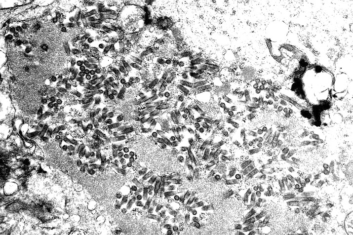 This electron microscope image made available by the Centers for Disease Control and Prevention shows rabies virions, dark and bullet-shaped, within an infected tissue sample. Five Americans died of rabies in 2021 — the largest number in a decade — and health officials say some occurred because people didn’t realize they’d been infected or refused life-saving shots. (F. A. Murphy/CDC via AP)