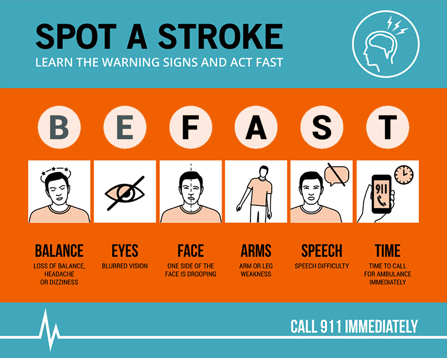 Stroke symptoms require emergency treatment even if they quickly ...