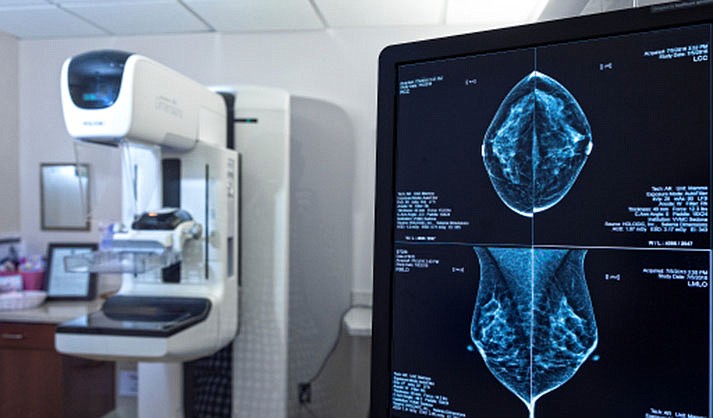 3D Mammogram machine used for the $85 mammograms in October (Courtesy/Lauren Silverstein)