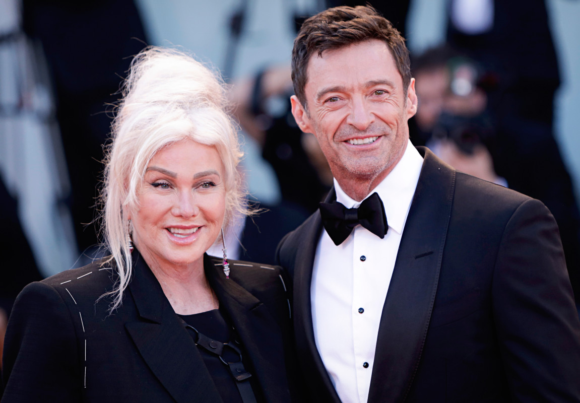 The Way They Were Hugh Jackman And Deborra Lee Furness The Verde